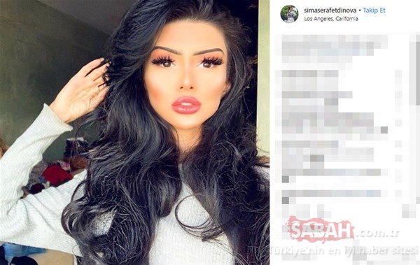 Pilot olan Sima Şərafəddinova keçirdiyi əməliyyatlarla bu hala düşdü - FOTOLAR