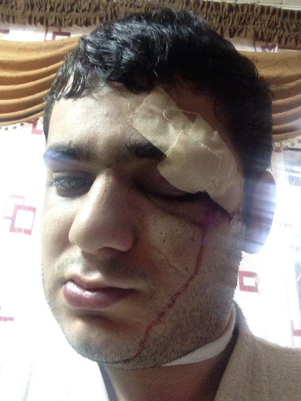 "Çılpaq qızlar" videosuna görə 5 nəfər saxlandı: qızlar da polisdədir...
