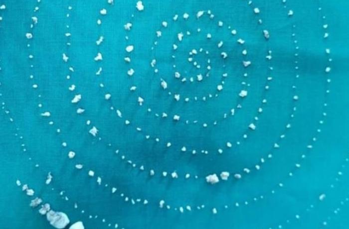 7 yaşlı uşağın çənəsindən 526 diş çıxarıldı - FOTO