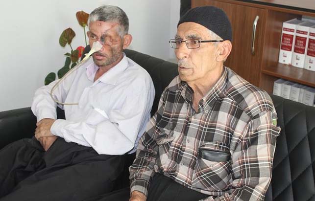 Dişini çəkdirən kişinin gözünü də çıxardılar – Foto