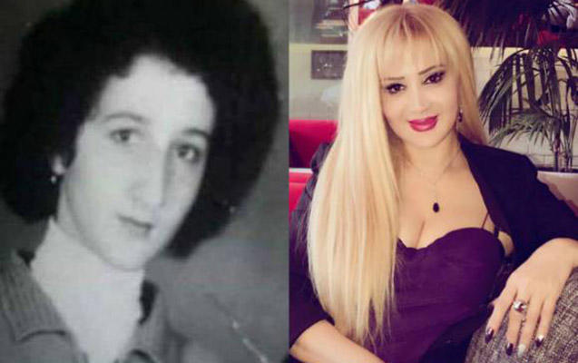 Estetik əməliyyatlarla dəyişən məşhurlarımız - FOTO