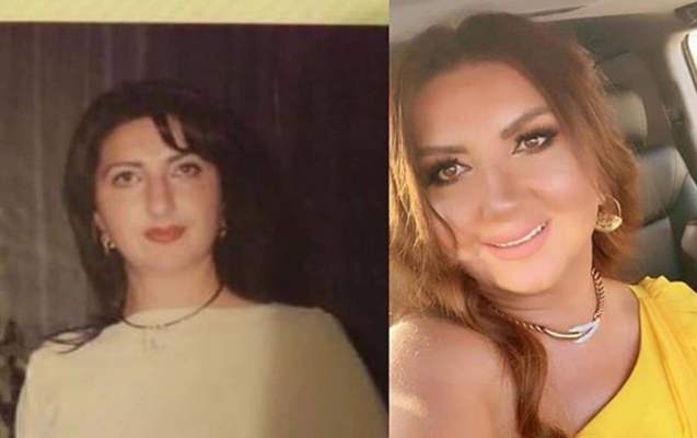 Estetik əməliyyatlarla dəyişən məşhurlarımız - FOTO