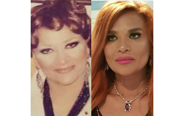 Estetik əməliyyatlarla dəyişən məşhurlarımız - FOTO