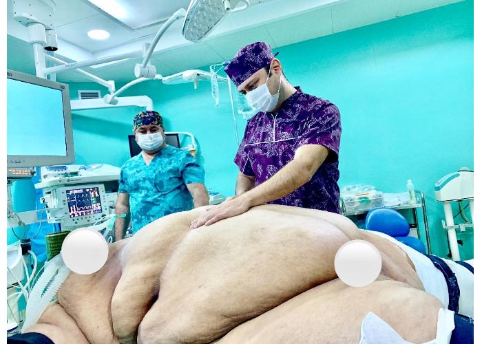 Azərbaycanlı həkim 256 kq çəkisi olan qadını əməliyyat etdi - FOTO