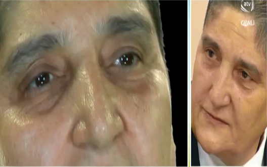 Ardıcıl 4 ailə üzvünü itirən xalq artisti XƏSTƏLİYƏ TUTULUB - Artıq bədənimdə... - VİDEO