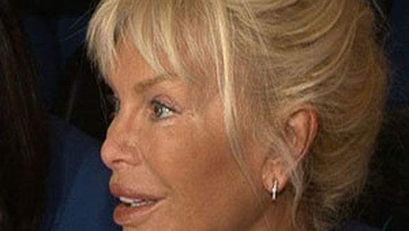 73 yaşlı Ajda Pekkanın estetik əməliyyatlarının sayı açıqlandı