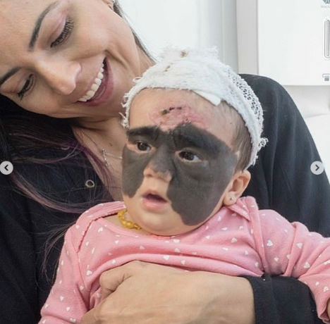 "Betman maska"lı amerikalı uşaq Rusiyada əməliyyat olunduqdan sonra - FOTO-VİDEO