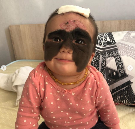 "Betman maska"lı amerikalı uşaq Rusiyada əməliyyat olunduqdan sonra - FOTO-VİDEO
