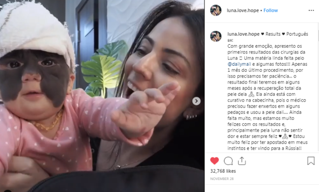 "Betman maska"lı amerikalı uşaq Rusiyada əməliyyat olunduqdan sonra - FOTO-VİDEO