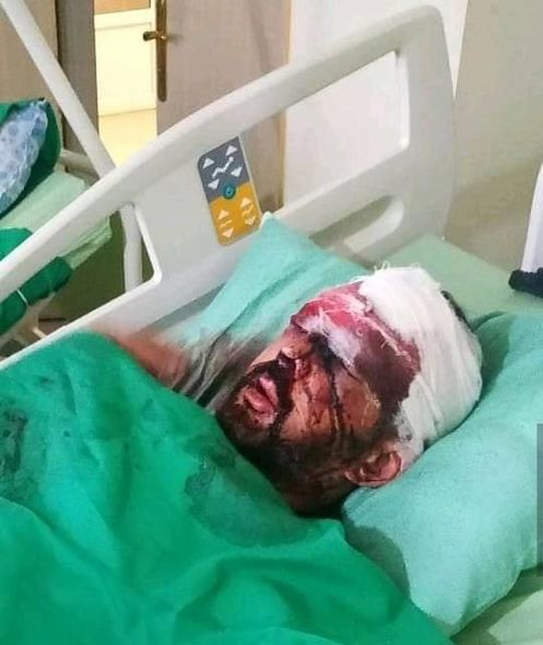 Azərbaycanlı müğənni ağır qəzaya düşdü - FOTO