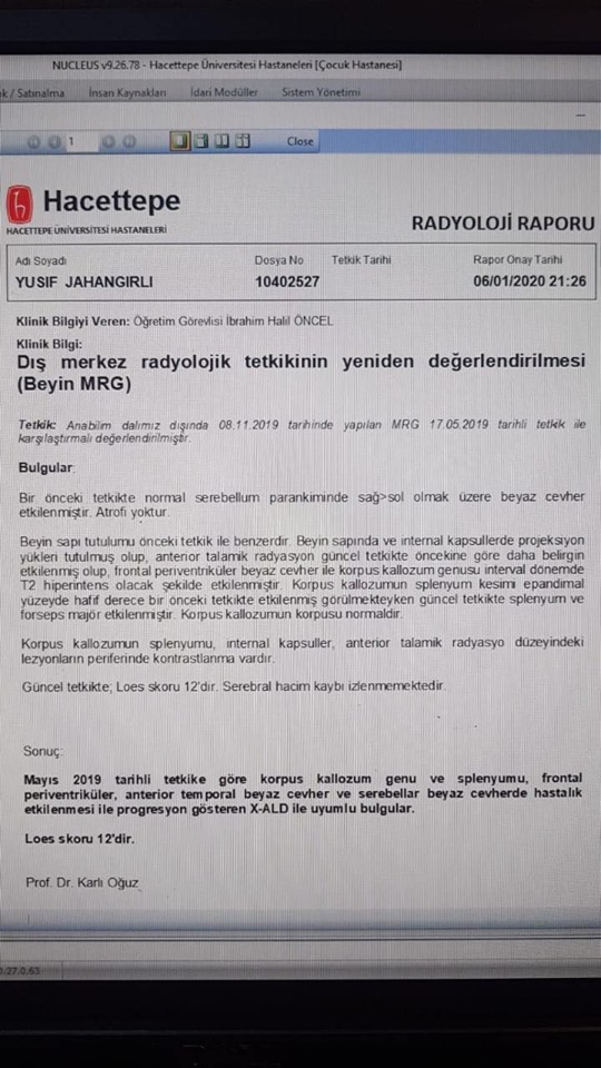 Nadir xəstəliyə tutulan 10 yaşlı Yusifi xilas edək – ÜRƏKPARÇALAYAN MÜRACİƏT