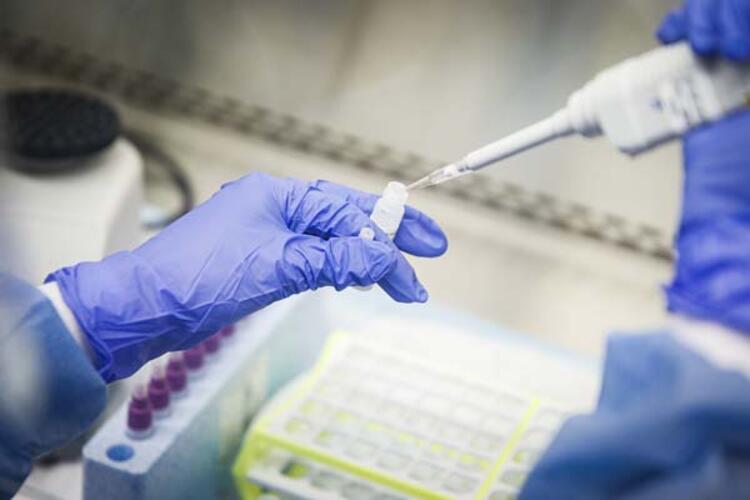 Koronavirus ən çox bu xəstəliklərdən əziyyət çəkənləri öldürür — STATİSTİKA