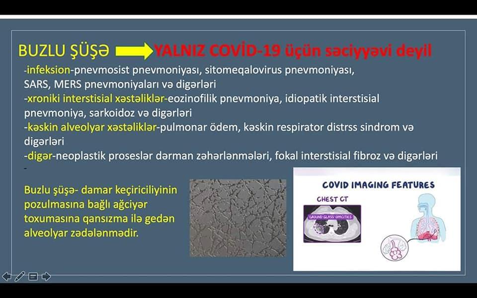 Hər kəsi qorxudan “buzlu şüşə” nədir?