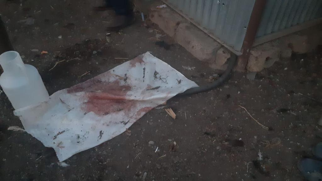 Bərdəyə kasetli raketlər atılıb, yaralıların sayı 13-ə çatdı - FOTO