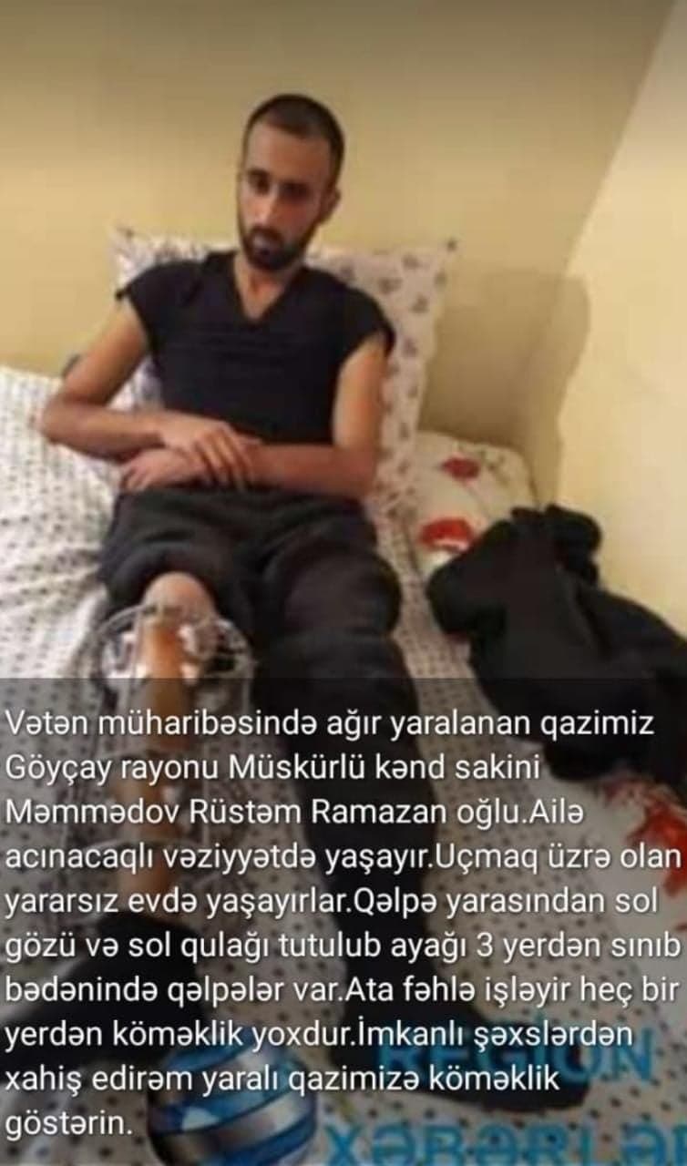 "Yaralarını kiçik bacısı sarıyır, ailəsi isə çox imkansızdır"- Yaralı əsgərin köməyə ehtiyacı var!!!
