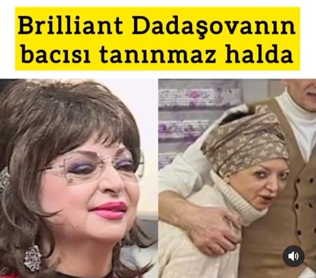 Lalə Dadaşova tanınmaz halda - FOTO