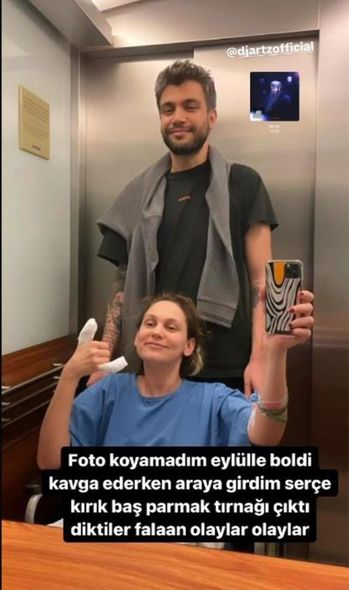 Türkiyəli məşhur aktrisa xəstəxanalıq oldu - FOTO