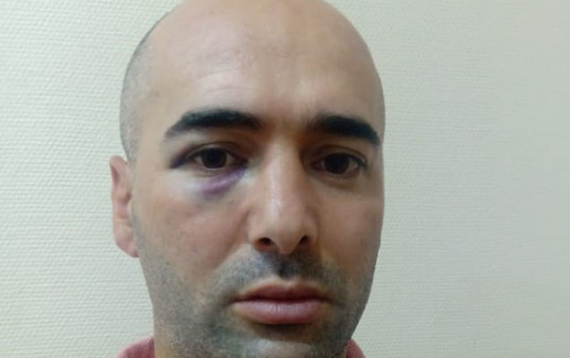Xəstəxanada döyüldüyü deyilən qazi ilə bağlı AÇIQLAMA