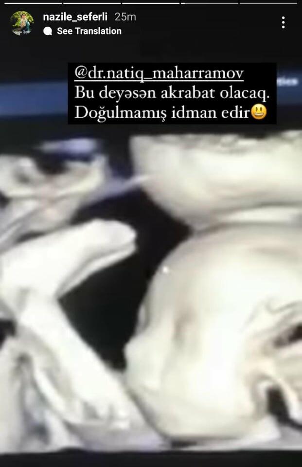 Boşanma xəbərləri yayılan Nazilə Səfərli növbəti dəfə ana olacaq - “UZİ” görüntülərini paylaşdı - FOTO