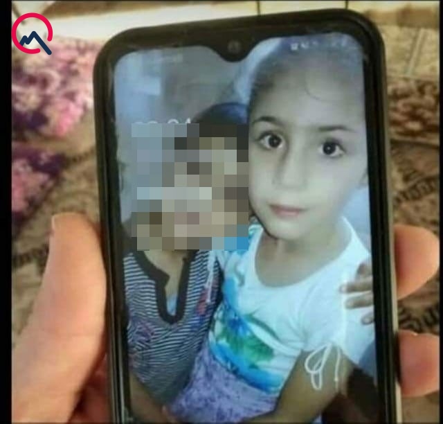 Zərdabda yanğında ölən qızın və yaralı qardaşının FOTOSU