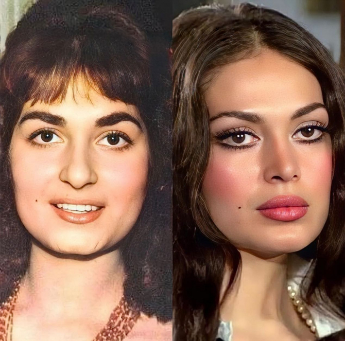 Türkan Şorayı dəyişdirən PLASTİK ƏMƏLİYYATLAR və QİYMƏTLƏRİ - FOTOLAR