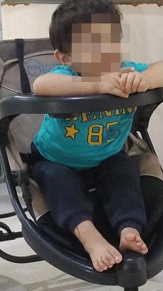 Bakıdakı xəstəxanada uşaqlar qotur xəstəliyinə tutulub: “Biz yetim-yesirə baxanıq?!” - FOTO
