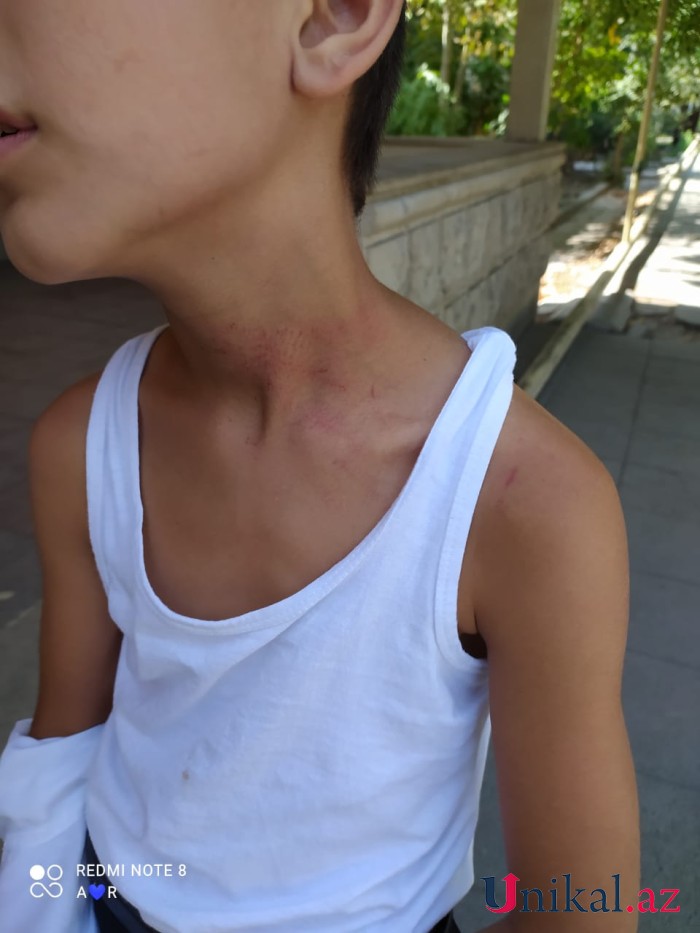 Yevlaxda məktəblilər dalaşdılar: Polis şagirdlərdən birini döydü - İDDİA + FOTOLAR