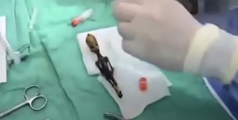 ABŞ-da alimlər “yadplanetli”nin skeletinin uzunmüddətli sirrini açdılar - FOTO