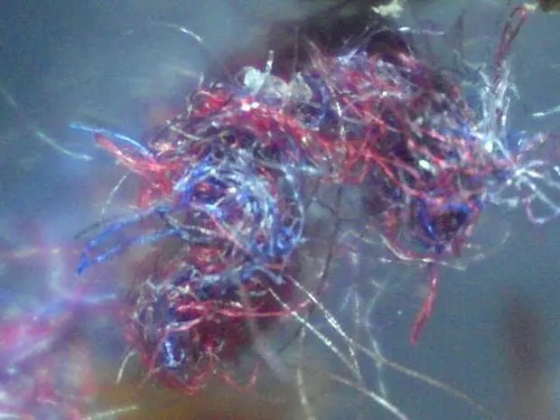 Dərinin altında həşərat hissi yaradan və müalicəsi mümkün olmayan xəstəlik - Morgellons simptomu