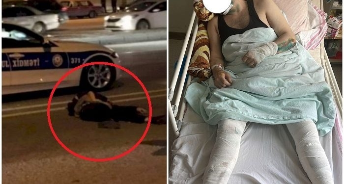 Piyadanı vurub qaçarkən başqasını da vurdu, evinə gedib özünü... - Bakıda film kimi olay + FOTO