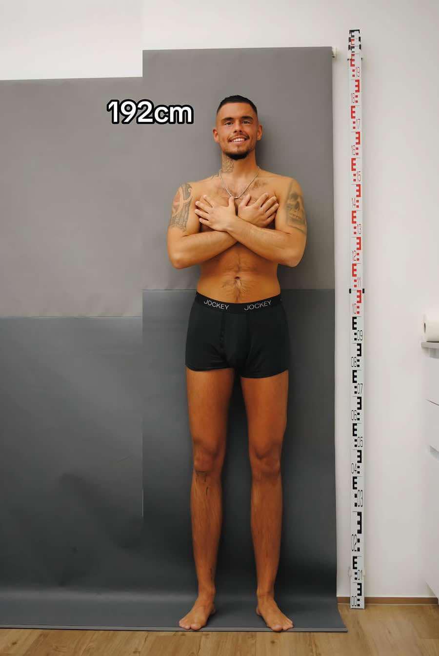 Zorakılığa məruz qaldığı üçün boy uzadılması əməliyyatı edən gəncin hekayəsi - FOTO
