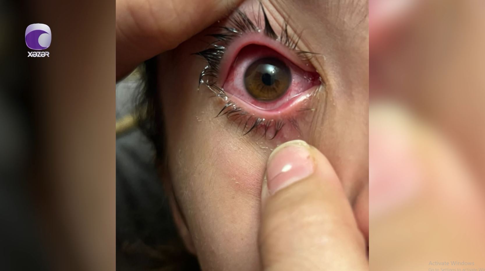 Masallıda dərs zamanı şagirdə nə olub? xəbəri üçün şəkil